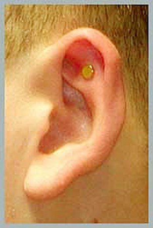 Zero Smoke, Thérapie d’acupression Quit Smoking, aimants antitabac pour arrêter de fumer, Aimants anti-tabac, aimant antitabac, acupression antitabac, arrêter de fumer, stop tabac, stop cigarette, patchs nicotine,  patch nicotine, non à la cigarette, arrê